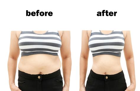 How To Lose Weight With An Apple Shaped Bodypeople With Abdominal Obesity Do These 4 Things