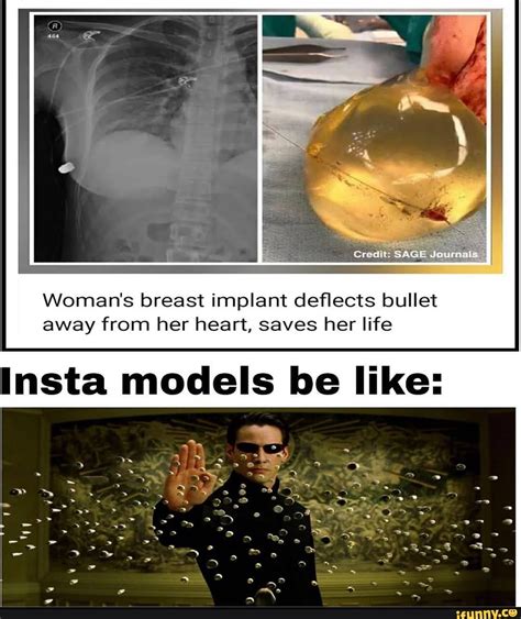 Womars Breast Implant Deflects Bullet Away From Her Heart Saves Her Life