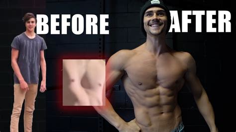 Why People With Pectus Are Always Skinny How To Fix Youtube