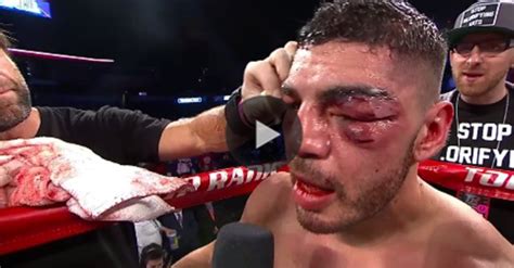 Последние твиты от ufc tonight (@ufctonight). Saturday Boxing Event Delivers Worst Eye Injury Of 2018 ...