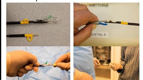 Emergency Transvenous Pacemaker Placement Youtube