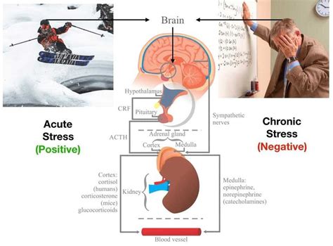 8 Mind Body Connection How Stress Impacts Physiology How A Person