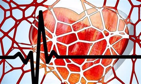 Determinar El Riesgo Cardiovascular A Pacientes Con Vih Para Evitar Posibles Eventos