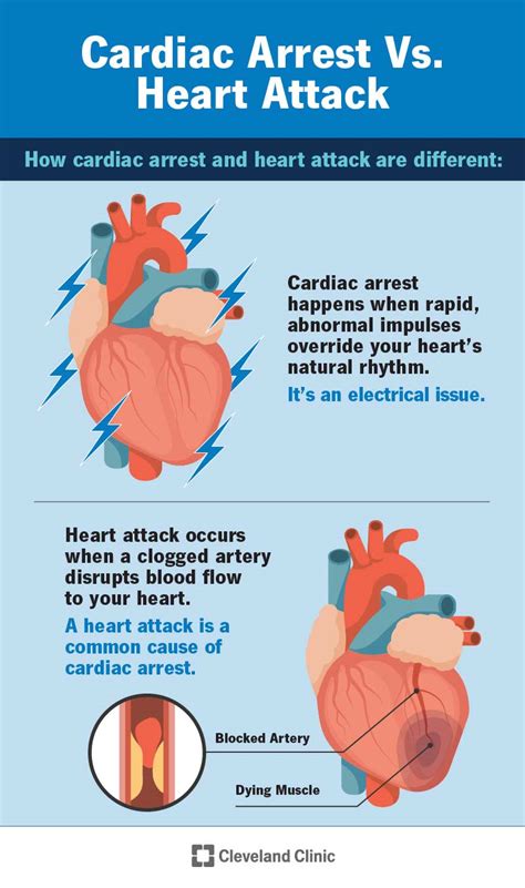Sudden Cardiac Arrest Causes And Symptoms