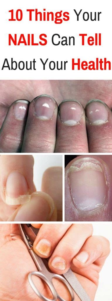 10 things your nails can tell you about your health health