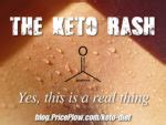 The Keto Rash Cure