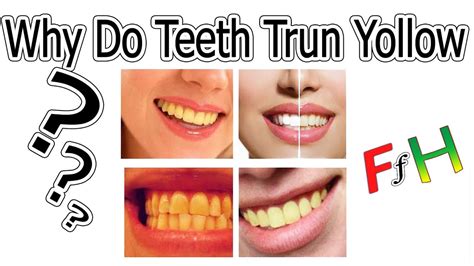 The most common reason that plants' leaves turn yellow is because of moisture stress, which can be from either over watering or under watering. Why do teeth turn yellow Fit for Health - YouTube