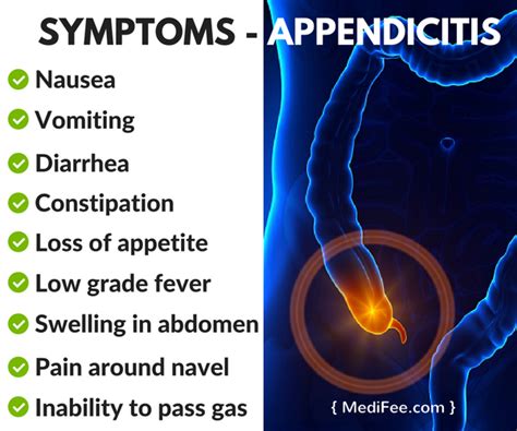 Appendicitis Signs And Symptoms