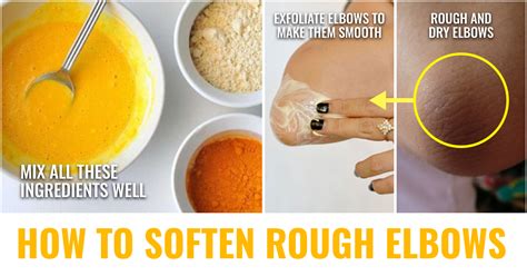 6 Ways To Achieve Incredibly Soft And Smooth Elbows