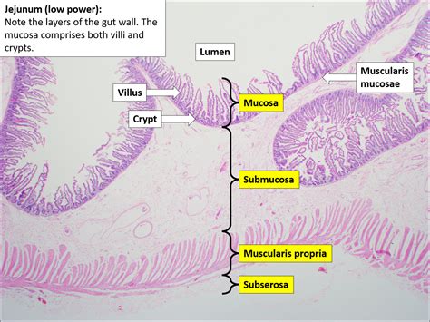 Small Bowel Normal Histology Nus Pathweb Nus Pathweb