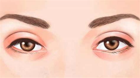 Was Verrät Deine Augenfarbe über Dich Besser Gesund Leben