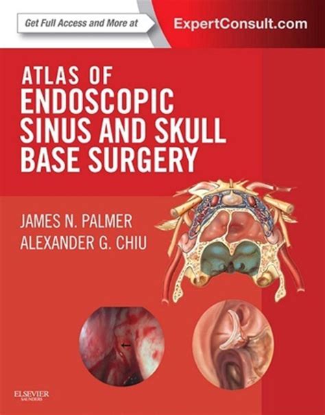 Calaméo Atlas Of Endoscopic Sinus And Skull Base