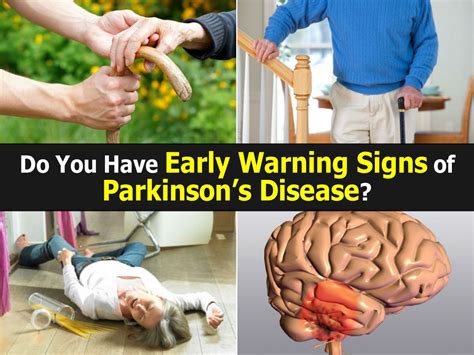 Do You Have Early Warning Signs Of Parkinsons Disease Info Kesehatan Dan Kecantikan Terupdate