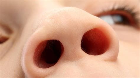 Childrens Noses Hold Clues To Serious Lung Infections Bbc News