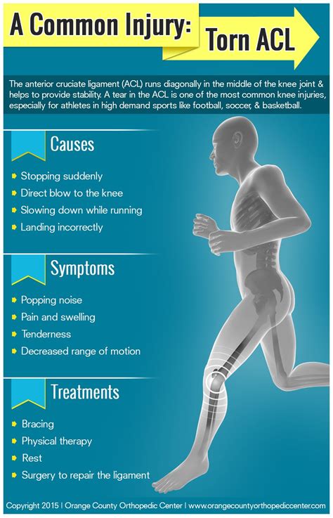 How To Know If You Torn Your Acl Inspire Ideas 2022