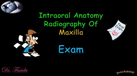 Normal Radiographic Anatomical Landmarks Intraoral Radiographic