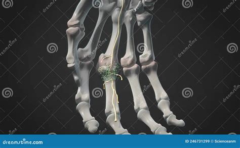 Swollen And Inflamed Finger Joints Stock Illustration Illustration Of