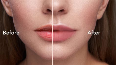 How To Remove Lip Wrinkles From Photos With A Free App Perfect