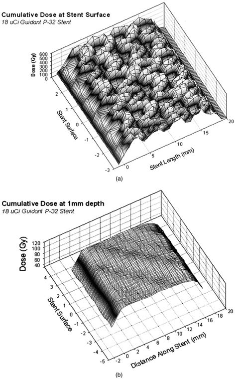 Effects Of 32p Radioactive Stents On In Stent Restenosis In A Double Stent Injury Model Of The