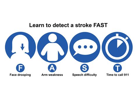 Mayo Clinic Minute Think Fast To Recognize A Stroke Mayo Clinic