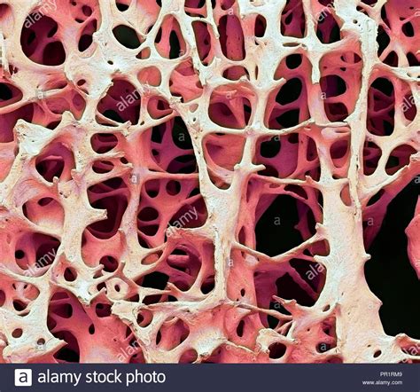 Spongy Bone Hi Res Stock Photography And Images Alamy