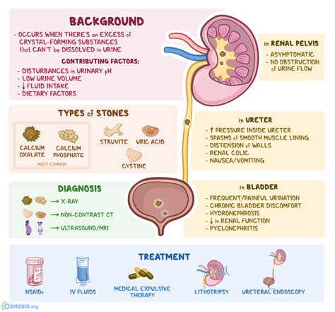 Nephrolithiasis What Is It Types Signs And Symptoms Diagnosis Treatment And More Osmosis