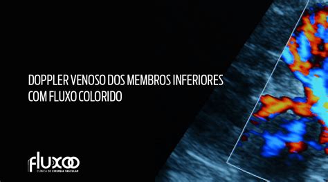 Doppler Venoso Dos Membros Inferiores Com Fluxo Colorido