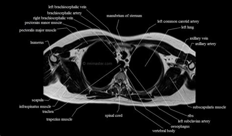 Back muscles rear view & #8211; chest anatomy | MRI chest (thorax)axial anatomy | free ...