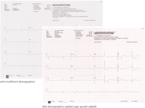 Mindray 12 Channel Electrocardiograph Beneheart R12 Medecexpress