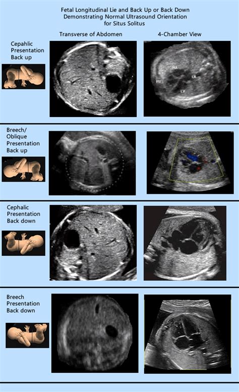 fetal ultrasound anatomy anatomical charts posters sexiz pix