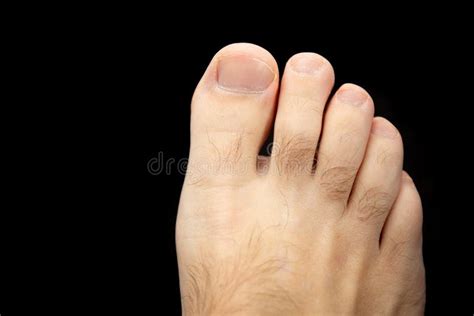 Male Foot Hair On The Toes Male Concept Stock Image Image Of Hairy
