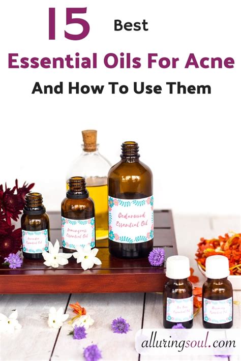 15 Best Essential Oils For Acne And Recipes