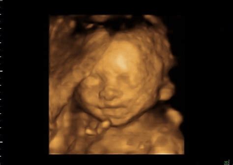 [最新] 24 weeks pregnant ultrasound 3d 214767 can you get a 3d ultrasound at 24 weeks