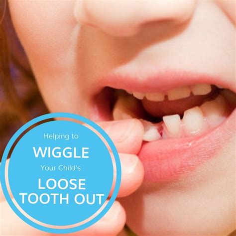 These two boys came up with a very unique way to pull the loose as the boy drives off, we can hear the fishing line make a stretch sound and the milk tooth is pulled out in no time. Help Wiggle Your Child's Loose Tooth Out | Potomac ...