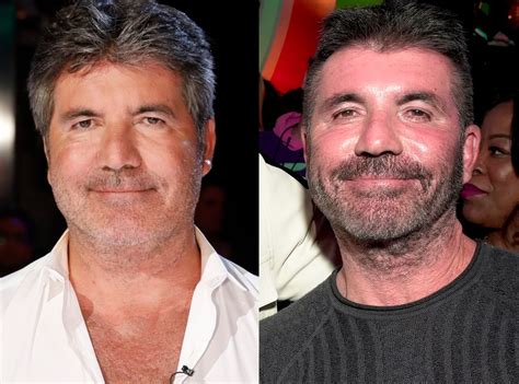 simon cowell plastic surgery before and after images explored the teal mango