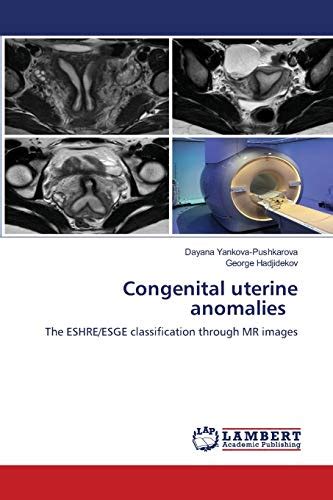 Congenital Uterine Anomalies The Eshre Esge Classification Through Mr