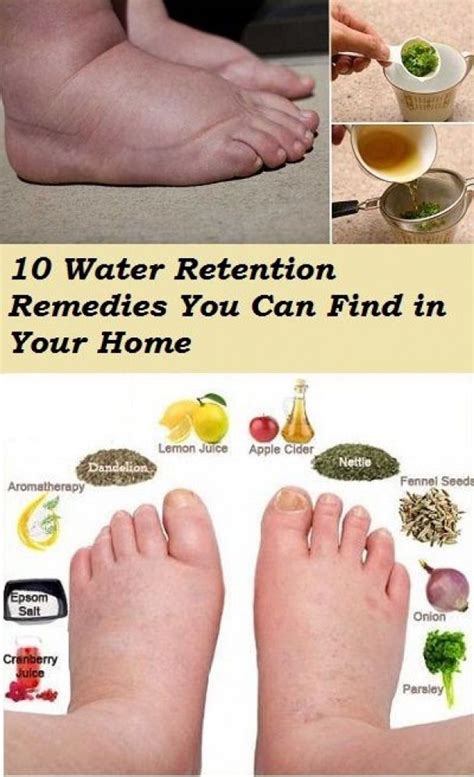 Exercise Inspiration 10 Water Retention Remedies You Can Find In Your