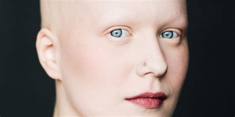 7 Stunning Portraits Of Women With Alopecia Redefine Femininity Huffpost