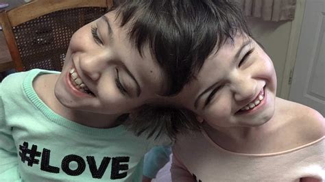 lori and george schappell 2021 10 longest living conjoined twins therichest lori treedt op