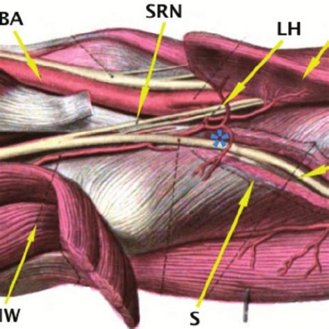 Posterior Interosseous Nerve