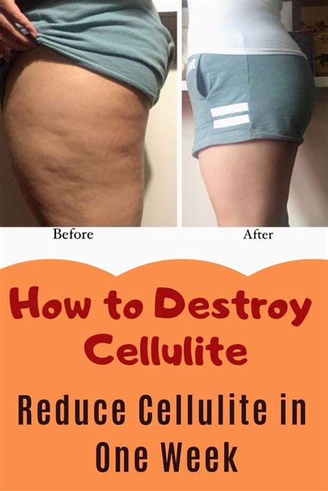 Pin On Cellulite Workout