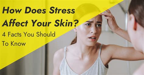 4 Facts To Know About Stress And Your Skin 7e Wellness