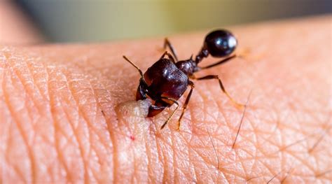 How Long Do Carpenter Ant Bites Last Picture Of Carpenter