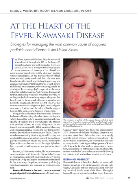 Pdf At The Heart Of The Fever Kawasaki Disease