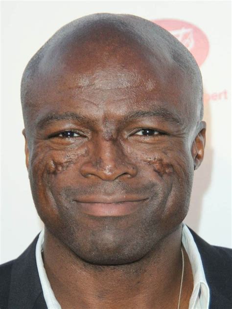 Seal More Than Our Childhoods