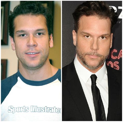 Dane Cook Plastic Surgery — Experts Weigh In On His Transformation