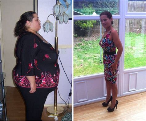 Morbidly Obese Woman Rejects Gastric Band Op Loses 20st The Old