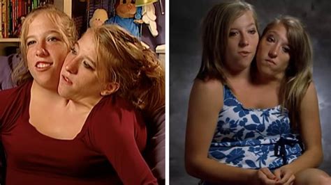Conjoined Twins Abby And Brittany Hensel Dream Of Getting Married And