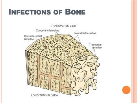 Ppt Skin Soft Tissue And Bone Infections Powerpoint Presentation