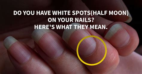 Do You Have White Spotshalf Moon On Your Nails Heres What They Mean